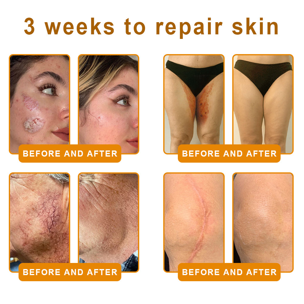LUMIVO™  Bee Poison Skin Restoration Cream 👨‍⚕️（🔥LAST DAY SALE-80% OFF)🥇👩‍⚕️