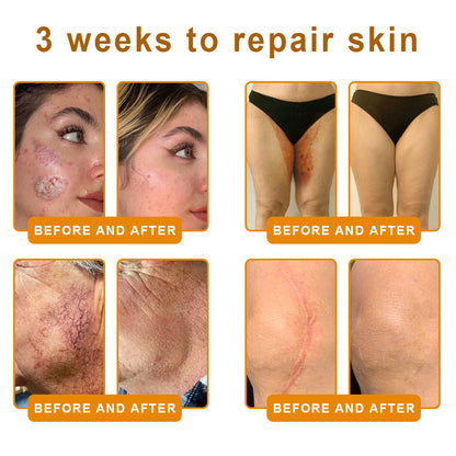 LUMIVO™  Bee Poison Skin Restoration Cream 👨‍⚕️（🔥LAST DAY SALE-80% OFF)🥇👩‍⚕️