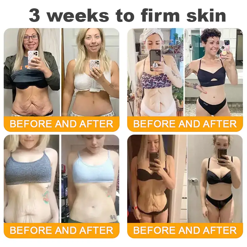 LUMIVO™ Advanced Bee Venom Skin Restoration Cream 🐝 (🔥EXCLUSIVE OFFER - 80% OFF TODAY ONLY) ✨👩‍🔬