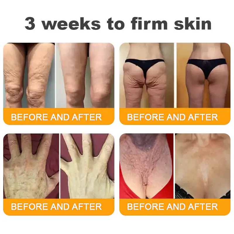 LUMIVO™  Bee Poison Skin Restoration Cream 👨‍⚕️（🔥LAST DAY SALE-80% OFF)🥇👩‍⚕️