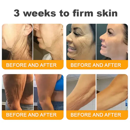 LUMIVO™ Advanced Bee Venom Skin Restoration Cream 🐝 (🔥EXCLUSIVE OFFER - 80% OFF TODAY ONLY) ✨👩‍🔬