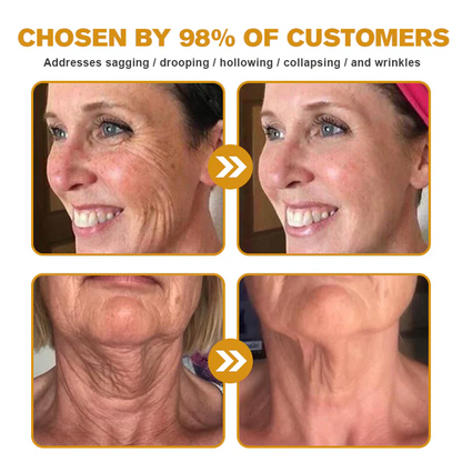 LUMIVO™ Advanced Bee Venom Skin Restoration Cream 🐝 (🔥EXCLUSIVE OFFER - 80% OFF TODAY ONLY) ✨👩‍🔬