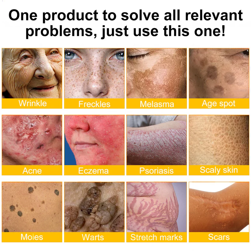 LUMIVO™ Advanced Bee Venom Skin Restoration Cream 🐝 (🔥EXCLUSIVE OFFER - 80% OFF TODAY ONLY) ✨👩‍🔬